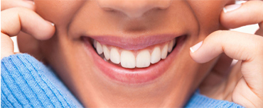 Teeth Whitening